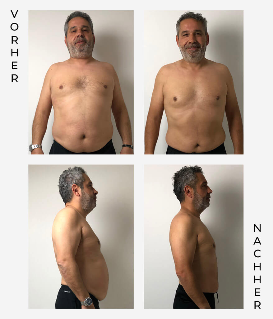 Ein Mann mittleren Alters steht ohne Hemd für Vorher-Nachher-Fotos zur Verfügung, die Vorder- und Seitenansichten zeigen. Die linken Bilder sind mit "Vorher" beschriftet, die rechten mit "Nachher". Auf den Nachher-Fotos sind ein deutlicher Gewichtsverlust und eine verbesserte Körperhaltung zu erkennen.