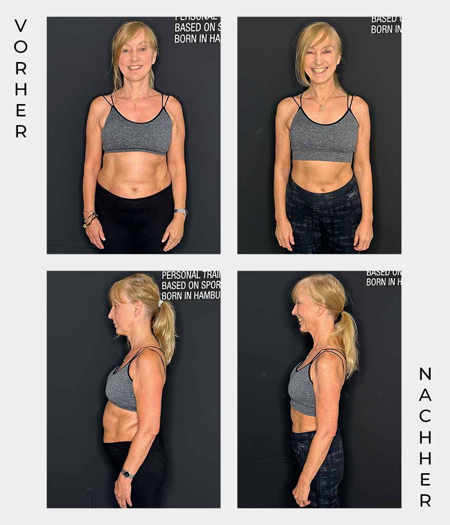 Vorher Nachher Vergleich als Referenz aus dem Personal Training bei Athletik Docks in Hamburg - Jutta